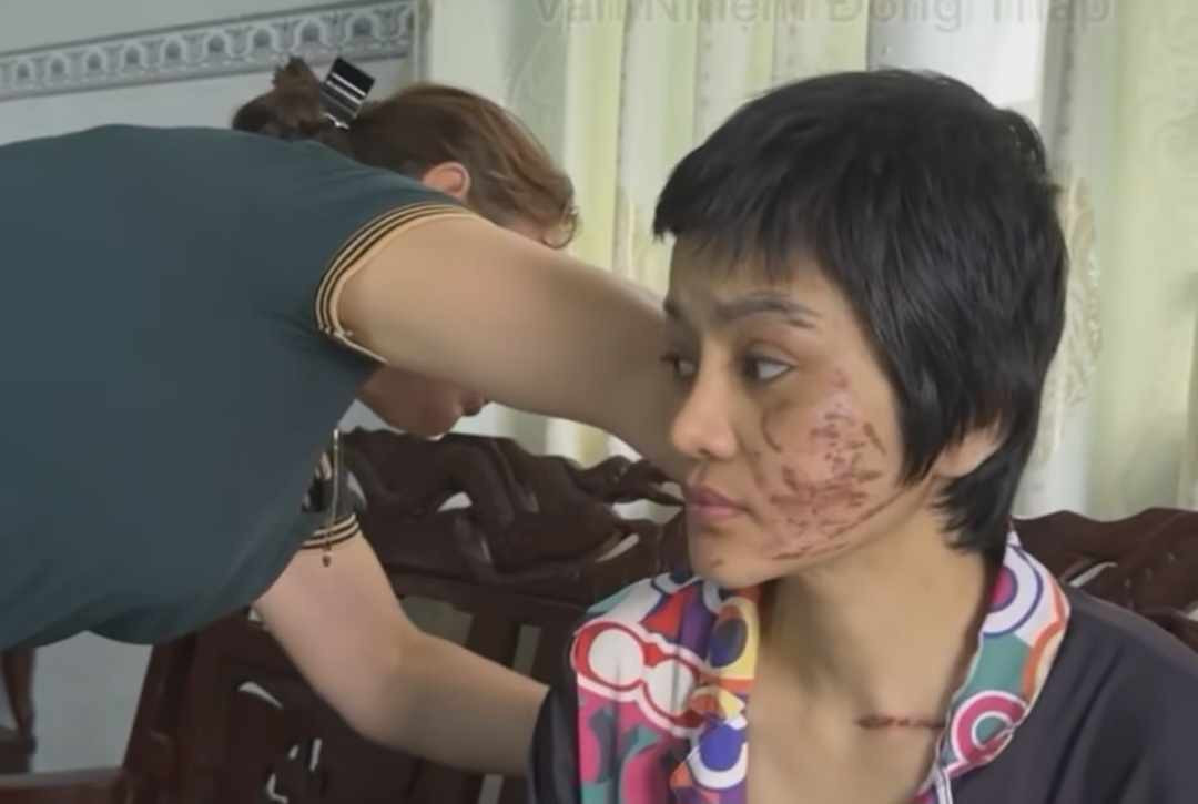 Thai phụ Kiên Giang tố chồng bạo hành: Có căn cứ để khởi tố vụ án? Thai phu Kien Giang to chong bao hanh: Co can cu de khoi to vu an?