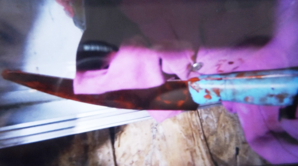 Con dao cắm vào tay anh T.