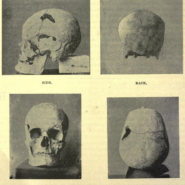 Thông tin về quyền cai trị của ông, thời gian ông cai trị, ông chết bởi nguyên nhân nào hay thời gian nào thì vẫn còn rất mơ hồ. Những thông tin về vị Pharaoh này chủ yếu đến từ một vài di tích đã tồn tại hơn 5.000 năm.