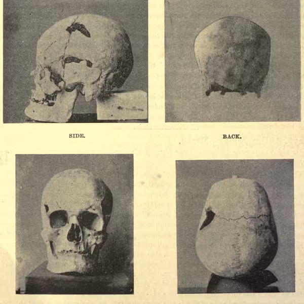 Thông tin về quyền cai trị của ông, thời gian ông cai trị, ông chết bởi nguyên nhân nào hay thời gian nào thì vẫn còn rất mơ hồ. Những thông tin về vị Pharaoh này chủ yếu đến từ một vài di tích đã tồn tại hơn 5.000 năm.