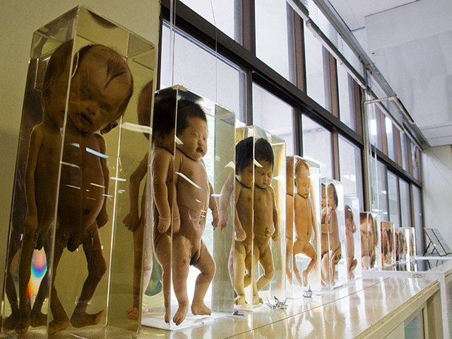 1. Bảo tàng Siriraj (bảo tàng của cái chết) - Thái Lan: Bảo tàng y khoa Siriraj, là nơi trưng bày những hình ảnh về các bộ phận trong cơ thể con người. Các buổi triển lãm sẽ cho bạn thấy hình ảnh thật của bộ não người, những chiếc đầu lâu với phần xương sọ bị đạn bắn thủng. Vậy nên, hãy suy nghĩ thật kỹ trước ghé thăm nơi này.