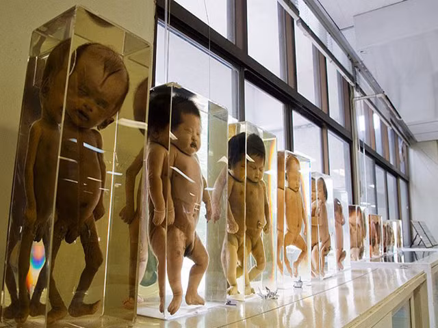 1. Bảo tàng Siriraj (bảo tàng của cái chết) - Thái Lan: Bảo tàng y khoa Siriraj, là nơi trưng bày những hình ảnh về các bộ phận trong cơ thể con người. Các buổi triển lãm sẽ cho bạn thấy hình ảnh thật của bộ não người, những chiếc đầu lâu với phần xương sọ bị đạn bắn thủng. Vậy nên, hãy suy nghĩ thật kỹ trước ghé thăm nơi này.