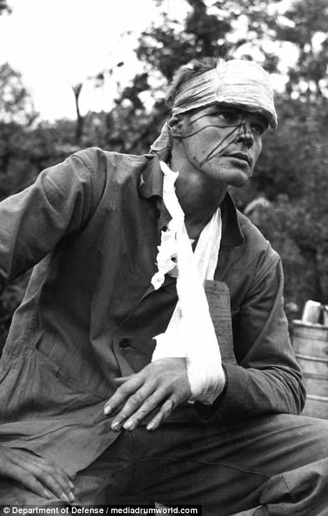 Một lính Mỹ với nhiều vết thương trên cơ thể khi tham gia làm nhiệm vụ ở bán đảo Triều Tiên.