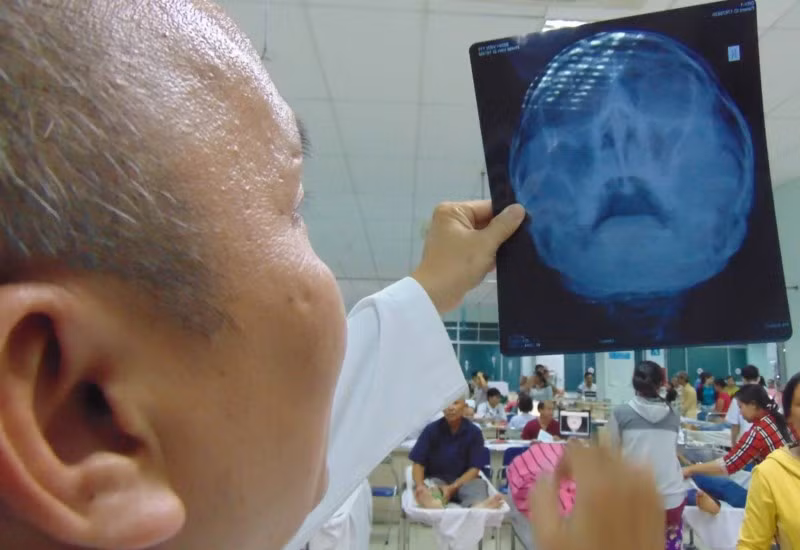 Nhung tai nan tu tren troi… giang xuong