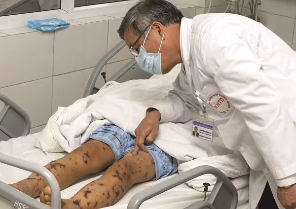 Dung nham sot xuat huyet voi benh co the chet trong vong 24 gio