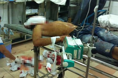 Một trong 2 nạn nhân đang điều trị tại bệnh viện do cơn ghen điên cuồng của đối tượng Chau Hương.