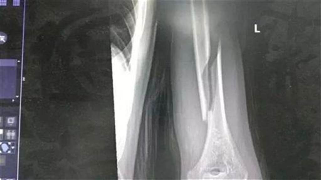 Mat ngu, cha va con bay tro la, gap chuyen kinh di