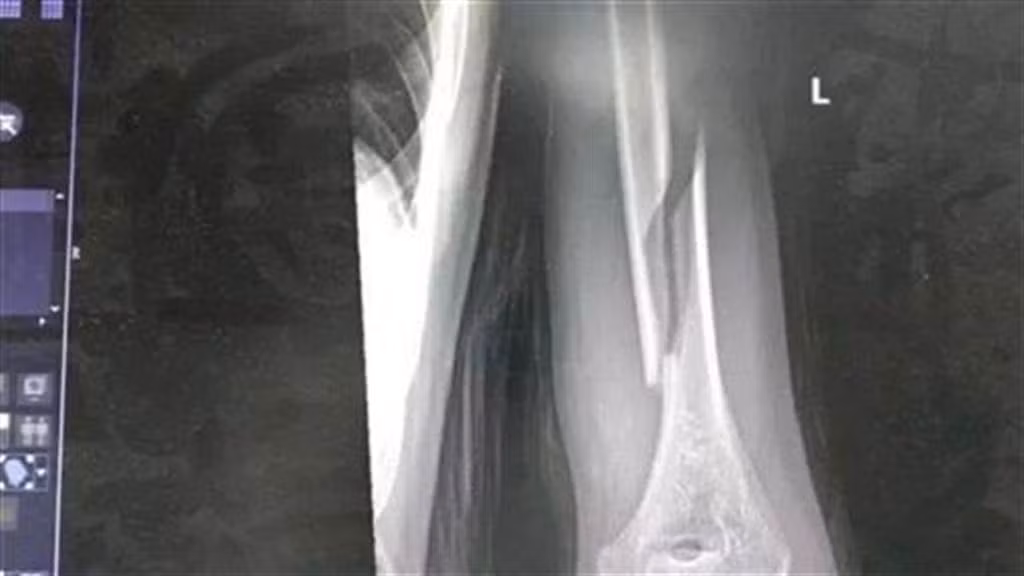 Mat ngu, cha va con bay tro la, gap chuyen kinh di