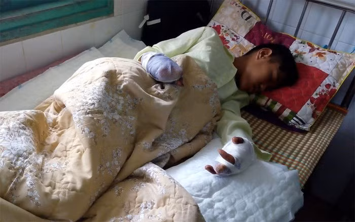 Bệnh nhân nhập viện vào chiều 29 Tết với vết thương phía trước người và hai bàn tay.