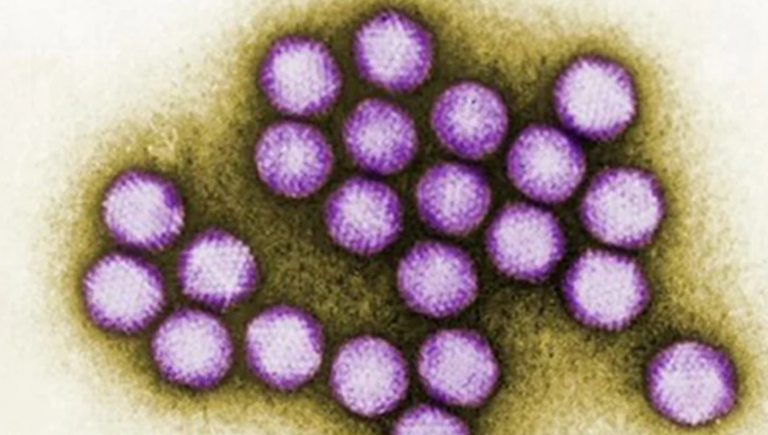 6 tre tu vong do virus Adeno: Bien chung nguy hiem sao?