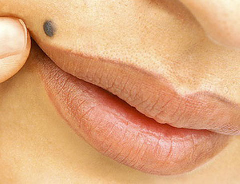 Not ruoi vi tri nao dem lai phu quy cho chu nhan?-Hinh-3