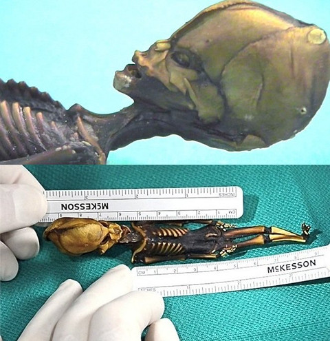 Hài cốt người ngoài hành tinh tý hon ở Chile. Hài cốt được cho là của người tí hon ngoài hành tinh ở Chile phát hiện năm 2003. Kết quả xét nghiệm ADN của bộ hài cốt được cho là của người tí hon ngoài hành tinh ở Chile phát hiện năm 2003 giống hệt con người. Xác chết có khuôn mặt kì dị, thân hình nhỏ thó và khá giống con người, chiều cao toàn bộ người tí hon chỉ khoảng 15,2 cm. Có ý kiến cho rằng rất có thể đây là tổ tiên của một giống người ngoài hành tinh nào đó.