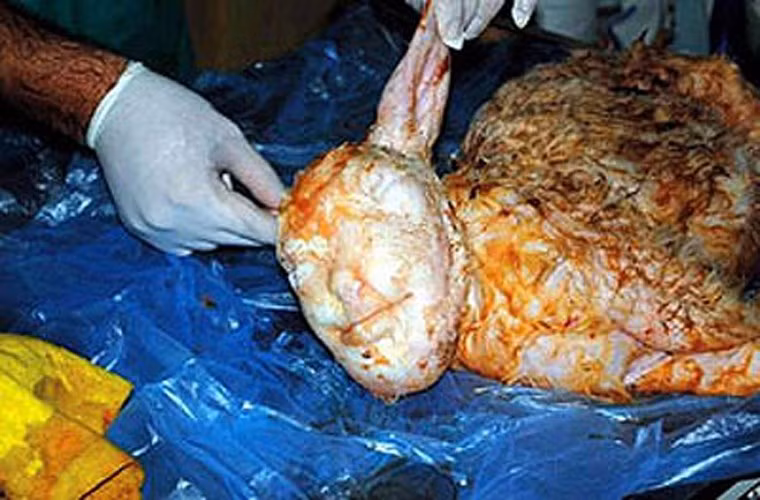 Một trường hợp khác, đó là trường hợp đột biến cừu sơ sinh có khuôn mặt hệt như một người đang cười ở thành phố Izmir, Thổ Nhĩ Kỳ cũng từng khiến nhiều người sửng sốt và bàn tán trong một thời gian dài.