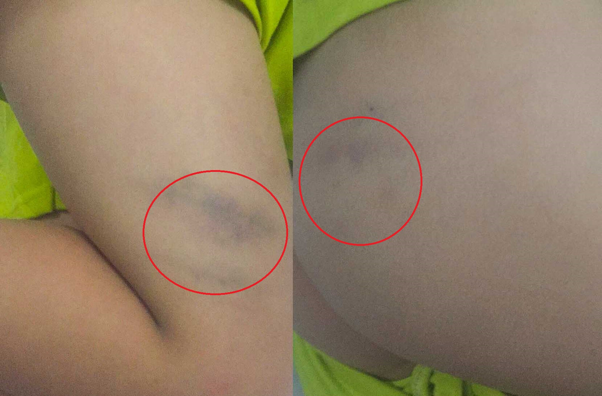 Phu huynh 'to' co giao danh con bam tim trong gio hoc