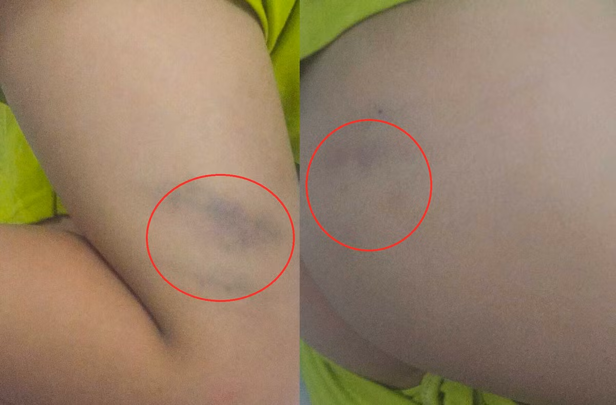 Phu huynh 'to' co giao danh con bam tim trong gio hoc