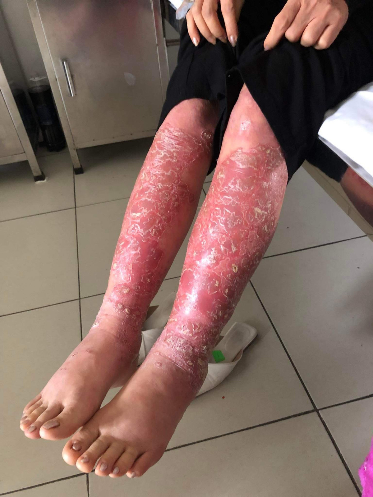 So Y te Da Nang noi gi vu dieu tri vay nen tai tham my Incheon?