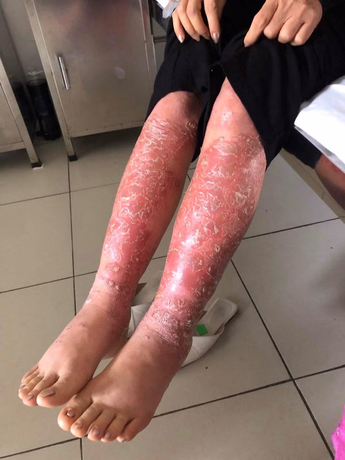 So Y te Da Nang noi gi vu dieu tri vay nen tai tham my Incheon?