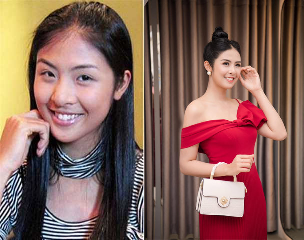Sau khi chỉnh sửa hàm răng, Hoa hậu Việt Nam 2010, Ngọc Hân, xinh hơn hẳn. (Ảnh: VTV, FBNV)