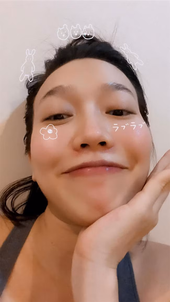 Khuôn mặt của cô được cho là bầu bĩnh hơn so với trước.