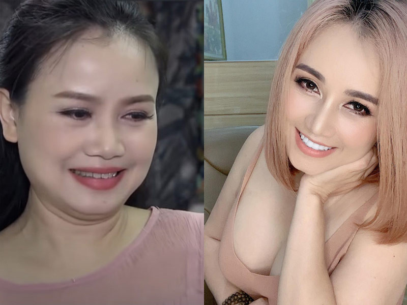 Sau khi ly hôn chồng thứ 4, Hoàng Yến đại tu lại nhan sắc từ sửa mũi tới nâng ngực, làm răng.