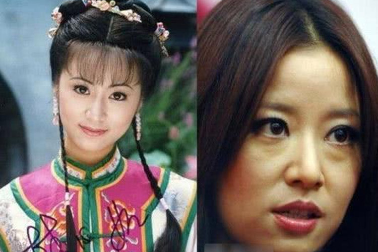 Làn da chảy xệ, bọng mặt, quầng thâm khiến Lâm Tâm Như bị già đi trông thấy. (Ảnh: Sohu)