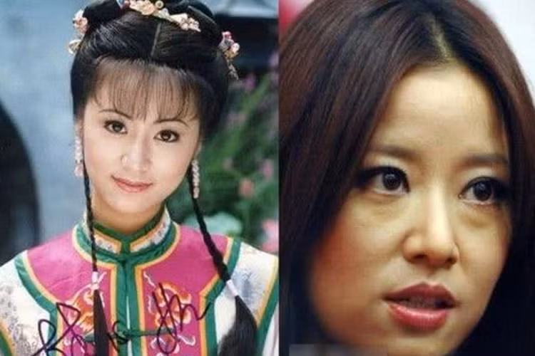 Làn da chảy xệ, bọng mặt, quầng thâm khiến Lâm Tâm Như bị già đi trông thấy. (Ảnh: Sohu)