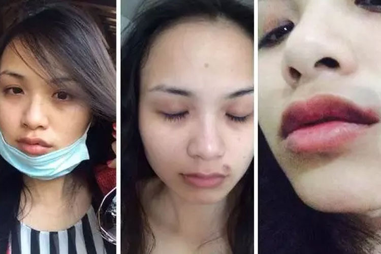 "Tôi đã có 3 năm sống không bằng chết. Bố mẹ tôi đều biết chuyện tôi bị bạo hành và rất phẫn nộ trước hành động của ông ấy", Hoa hậu Thế giới người Việt 2010 chia sẻ. (Ảnh: 2sao.vn)