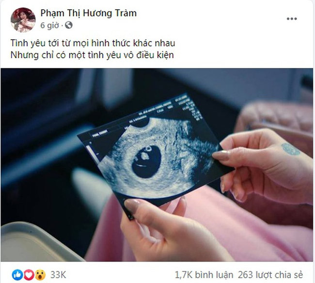 Vào đúng sinh nhật của mình (15/5), Hương Tràm khoe bức ảnh siêu âm thai nhi và viết trên trang cá nhân: "Tình yêu tới từ mọi hình thức khác nhau. Nhưng chỉ có một tình yêu vô điều kiện".