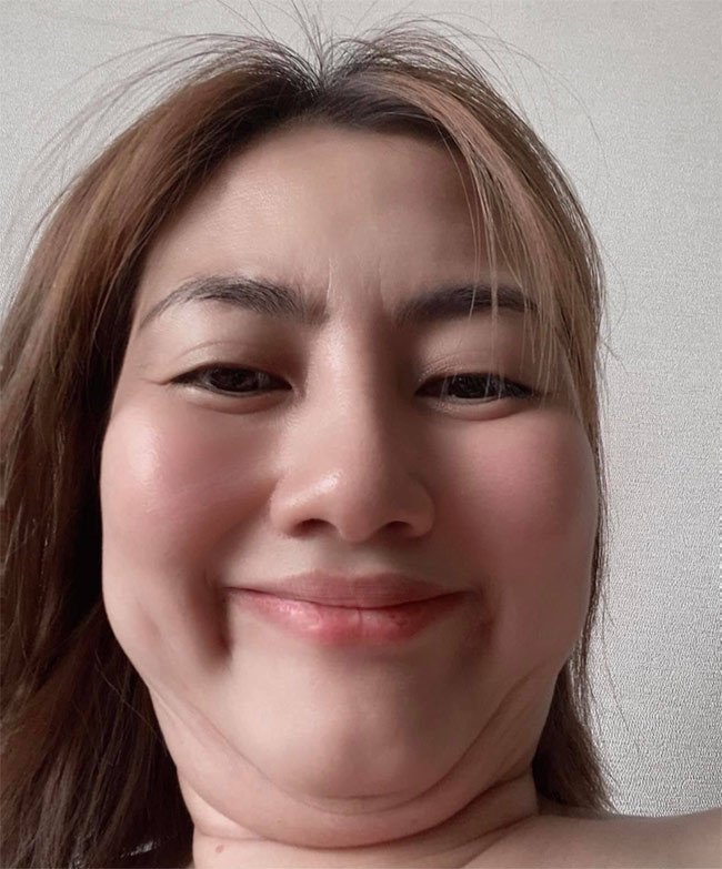 Tháng 8/2021, nữ diễn viên "Kiều nữ và đại gia" khiến cư dân mạng hốt hoảng khi khoe khuôn mặt rõ nọng cằm.