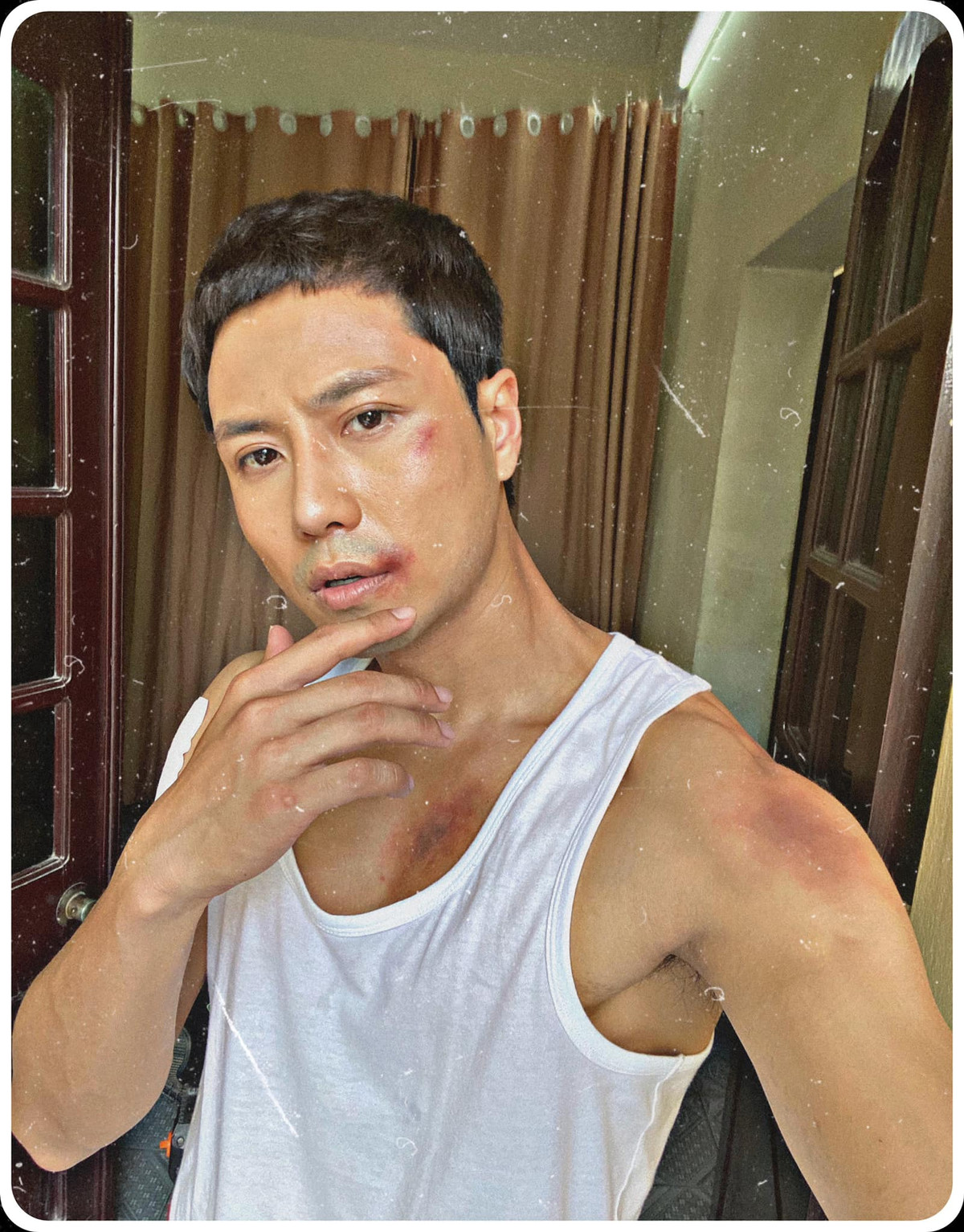 Thanh Sơn "no đòn" với những vết bầm tím trong phim ngay từ những tập đầu vì vô tình vướng phải những rắc rối của hai cậu cháu diễn viên Quang Thắng và Khả Ngân.