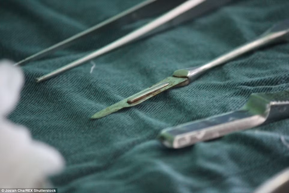 Dao mổ đã han gỉ vẫn được bác sĩ sử dụng trong quá trình phẫu thuật tại một bệnh viện Triều Tiên.