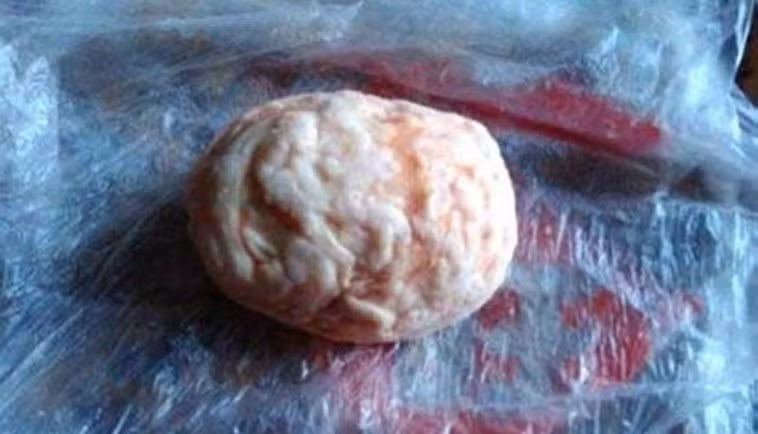 Theo một giáo sư của Viện Y học động vật thuộc Đại học Tứ Xuyên, Trung Quốc, "dị vật" này có thể là một viên Trư Sa quý hiếm.