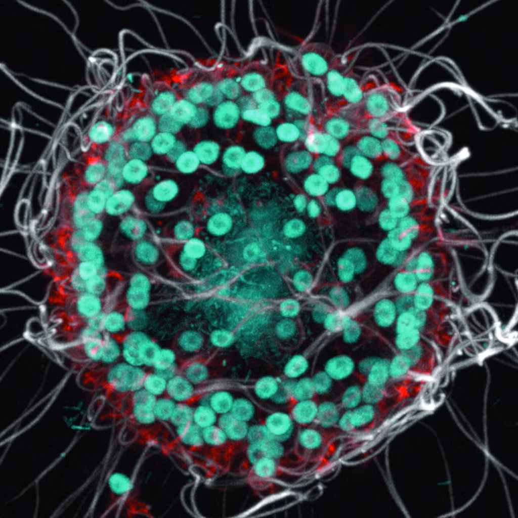 Barroeca monosierra bao gồm nhiều tế bào giống hệt nhau, mỗi tế bào có một cái roi (flagella) giúp chúng di chuyển trong nước. (Ảnh: Berkeley News)