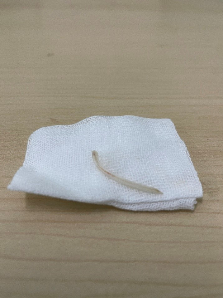 Nuot dau, khan tieng vi xuong ca dieu hong mac vao day thanh