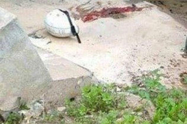  Người đàn ông tử vong bất thường dưới mương nước: Sáng 12/4, người dân phát hiện một thi thể được phát hiện dưới mương nước trên trục đường liên xã Nga Phượng (Nga Sơn, Thanh Hóa) gần đó có chiếc xe máy. Nạn nhân được xác định trú tại xã Nga Thủy (Nga Sơn), 28 tuổi. Nhận định ban đầu, có thể do đêm tối, không làm chủ được tay lái nên người này bị ngã, đập vào nền xi măng cứng nên dẫn tới tử vong.