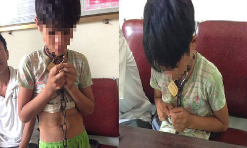 Be trai bi xich co: Nguoi cha co the bi tu 3 nam