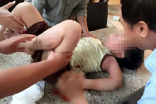 3. Hà Nội: Bé trai rơi từ tầng 10 chung cư dần qua cơn nguy kịch Khoảng 17h chiều ngày 11/8, tại khu chung cư NƠ4A, bán đảo Linh Đàm, phường Hoàng Liệt, quận Hoàng Mai, cháu P. (SN 2008) bất ngờ bị rơi từ tầng 10 xuống, trúng nóc quán lợp tôn ở tầng 1 tạo ra một vết thủng rồi tiếp tục rơi xuống bàn, ghế uống nước ở dưới, do chơi gần lan can không có lưới bảo vệ. Cháu P. được đưa đi cấp cứu trong tình trạng đa chấn thương, gãy rất nhiều xương, vỡ sọ não và chấn thương sọ não.