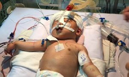 Gia canh dau long cua be trai 11 ngay tuoi bi dam xuyen dau-Hinh-2