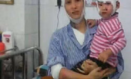 Hiện sức khỏe của mẹ con chị D. đã dần ổn định.