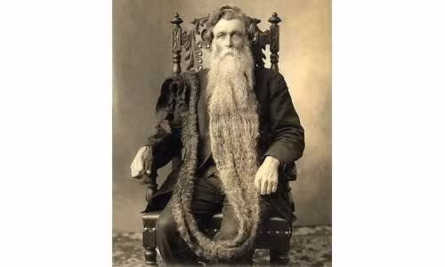 Hans Steininger (Áo) nổi tiếng với bộ râu dài nhất thế giới (gần 1,5 m). Cũng chính vì bộ râu này mà ông mất mạng. Cụ thể, năm 1567, khi xảy một vụ hỏa hoạn tại thị trấn nơi ông sống, do vội vàng chạy thoát thân mà ông quên mất việc phải cuộn gọn gàng bộ râu mình lại để dễ dàng di chuyển. Do vậy, ông đã mất thăng bằng vì dẫm phải bộ râu của mình dẫn đến bị trượt ngã, gãy cổ và tử vong ngay lập tức.