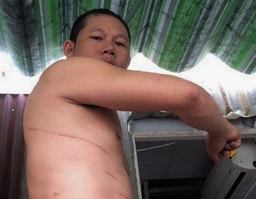 Những vết thương khắp trên mình người nghệ sĩ xiếc mạo hiểm.