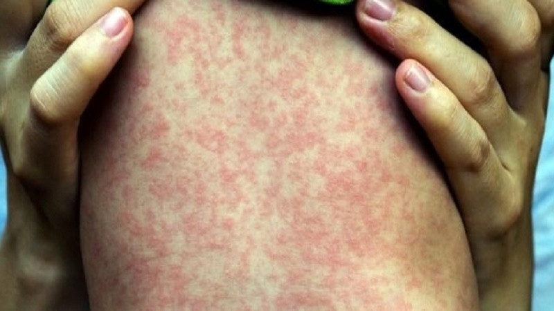 Cuu song be gai o Phu Tho bi bien chung soi