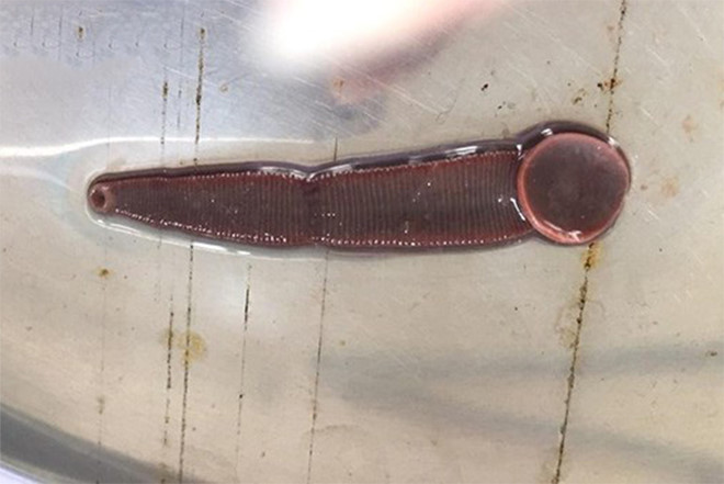 Rung ron dia ky sinh 3 thang trong mui nguoi dan ong