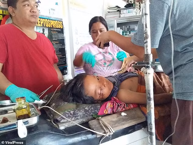 Con trai bi ca sau giang xe, nguoi cha lam dieu kho tin