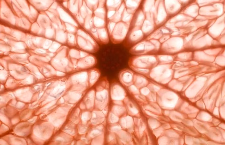 Một lát thịt? Hay da người dưới kinh hiển vi? Hay đậu tương lên men?