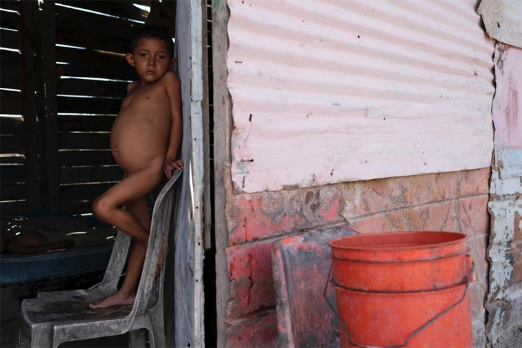 Thiếu dinh dưỡng sẽ khiến hàng trăm ngàn thiếu niên và trẻ em Venezuela giảm sự phát triển nhận thức và thể chất. Các bác sĩ và các chuyên gia y tế cho rằng, thế hệ thanh niên của Venezuela sẽ không bao giờ đủ tiềm năng về tinh thần và thể chât vì sự thiếu hụt dinh dưỡng này.