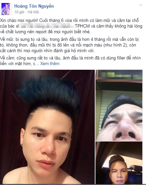 Guong mat bi bien dang Hoang Ton tiep tuc dao keo-Hinh-2