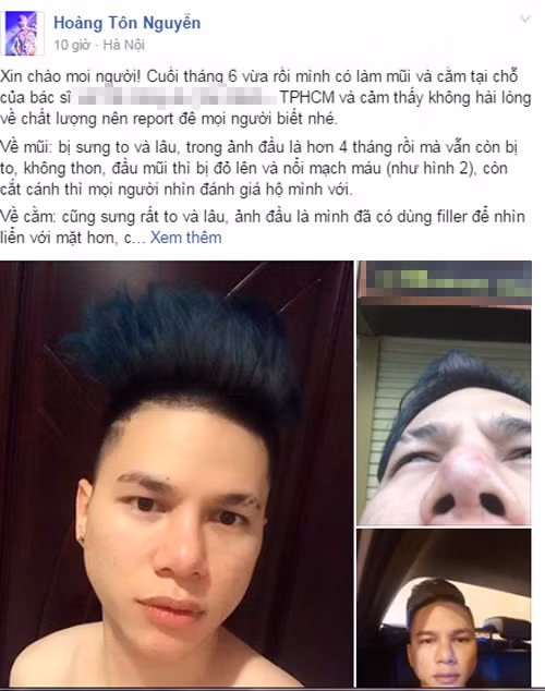 Guong mat bi bien dang Hoang Ton tiep tuc dao keo-Hinh-2