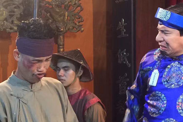 Hình ảnh "Thầy lang" Hiệp Gà với gương mặt tím bầm khiến nhiều người tò mò. (Ảnh: Facebook đạo diễn Phạm Đông Hồng)