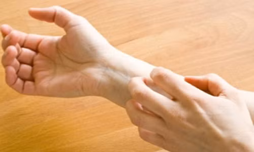 Bệnh giang mai. Ở giai đoạn thứ hai của bệnh giang mai, các tổn thương ngoài da là đào ban, sần cũng có thể xuất hiện ở vùng da đầu. Những tổn thương dẫn đến rụng tóc theo kiểu rừng thưa. Bác sỹ khuyên rằng, ở tất cả các thể rụng tóc lan tỏa đều cần phải làm xét nghiệm RPR để loại trừ nguyên nhân rụng tóc do bệnh giang mai gây nên.